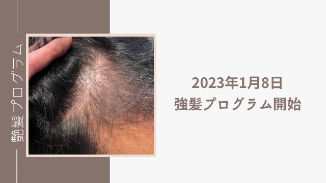 強髪プログラム『開始』｜強髪　口コミ｜ヒト幹細胞培養液　育毛